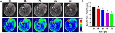 Synthesis of Fe3O4/PDA Nanocomposites for Osteosarcoma Magnetic Resonance Imaging and Photothermal Therapy